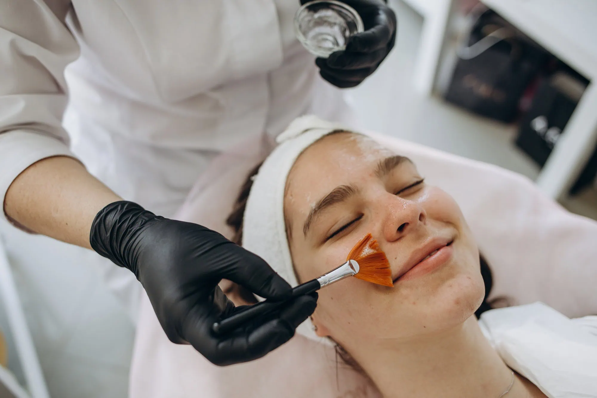 Chemical peel treatment by Forever Beauty Spa In Salt Lake city UT