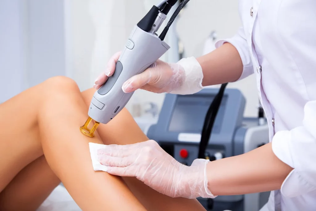 Laser Hair Removal treatment by Forever Beauty Spa In Salt Lake city UT