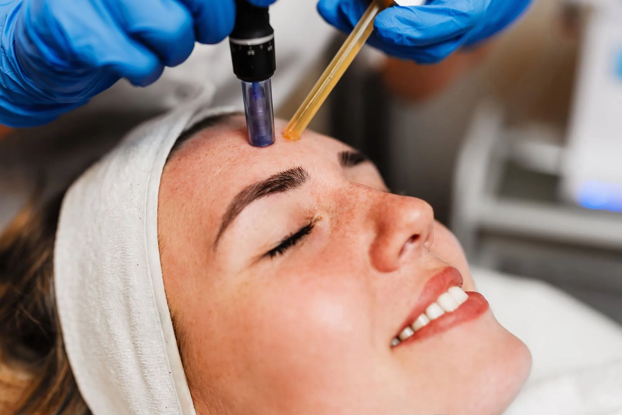 Microneedling Facial with PRP service by Forever Beauty Spa In Salt Lake city UT