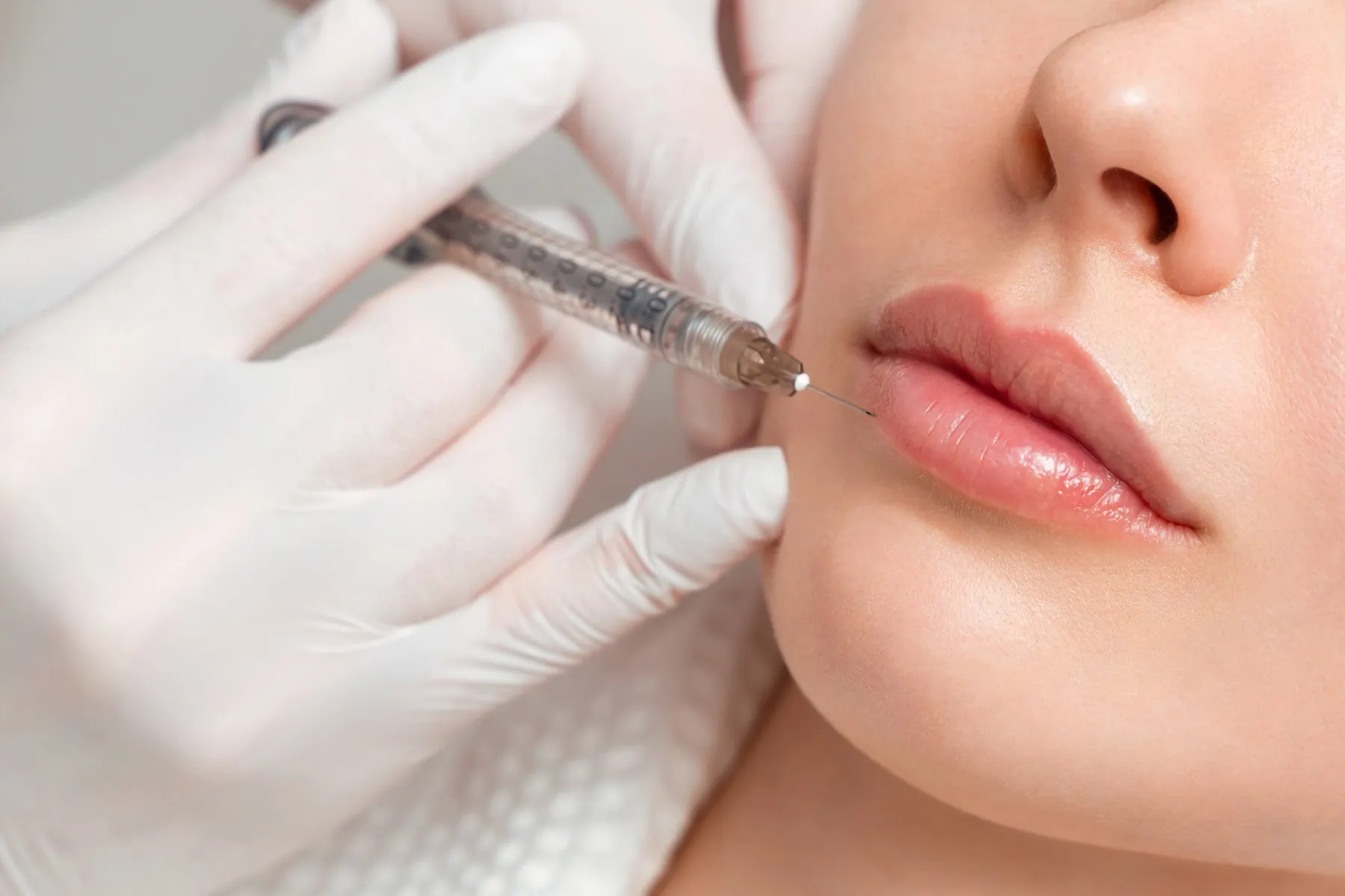 How Lip Fillers Can Enhance Your Natural Beauty | Forever Beauty Med Spa | Salt Lake City UT