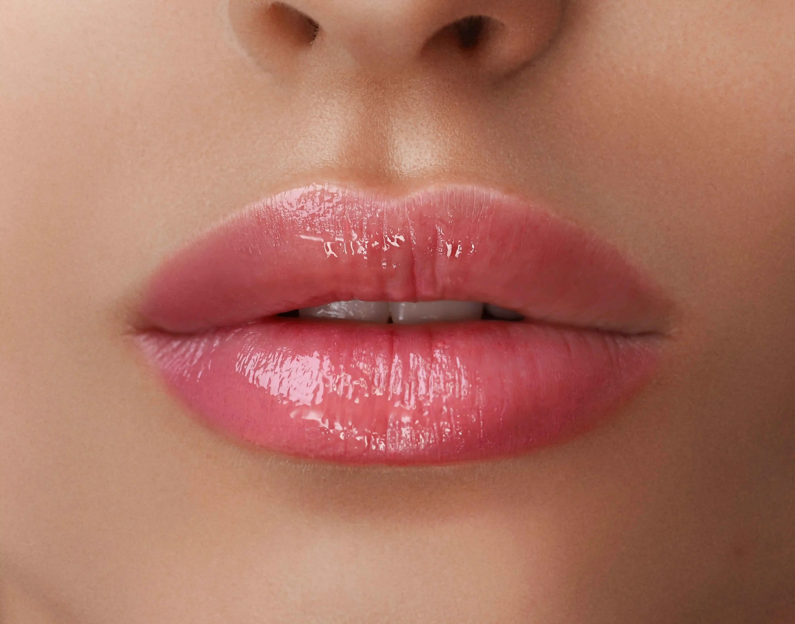 Natural-looking glossy pink lips after professional lip enhancement treatment at Forever Beauty Spa