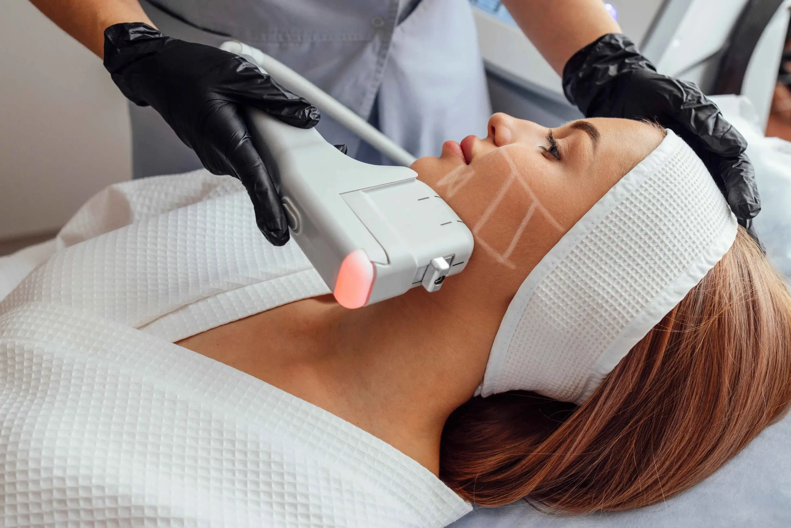 Non-Surgical Skin Tightening